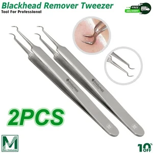Curved Tweezers Blackhead Remover Pimple Extractor Popper Acne Blemish Comedone - Picture 1 of 8