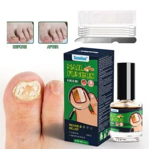Nail Treatment Fungus Fungal Anti toe Removal Cream Care Infection qamt//aa Z9F5 - Picture 1 of 13