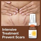Fade Away Stretch Mark & Scar Fade Oil ? Removes Colour & Texture Of Marks