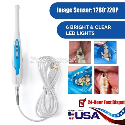 Cámara intraoral dental industrial USB2.0 1280*720P enfoque automático Ultra HD 6LED Foto 1 de 4