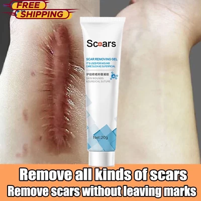 2x Scar Removal Cream Keloid & Stretch Mark Remover Scar Care for Burns Skin - Image 1 of 4