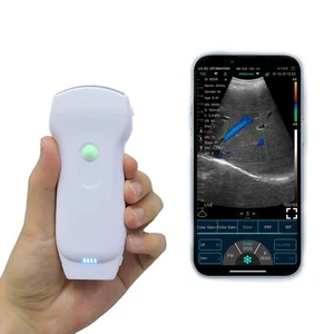 3-in-1 Double Heads 128 Elements Color Doppler Wireless Ultrasound Probe - Picture 1 of 16