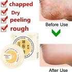Winter Cracked Skin Repair Cream For Hand & Feet Anti-Cracking Frost E0I1
