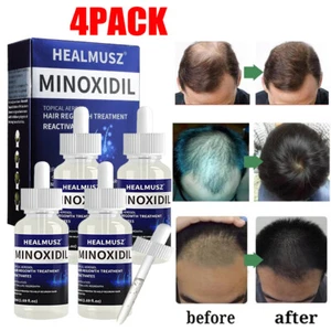 4X Extra Strength 5% Minoxidil for Men Hair Regrowth Treatment Topical Solution - Bild 1 von 19