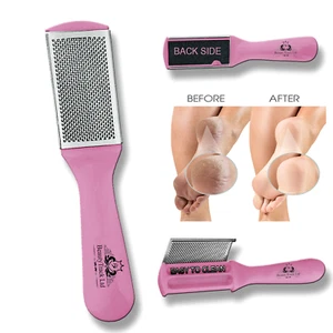 Pink Foot File Feet Rasp Hard Skin Callus Remover Pedicure Scrubber - Dual Sided - Picture 1 of 5