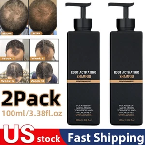 2PACK Root Activating Shampoo, Secret Hair Care Shampoo, Unisex Hair Shampoos US - Picture 1 of 14