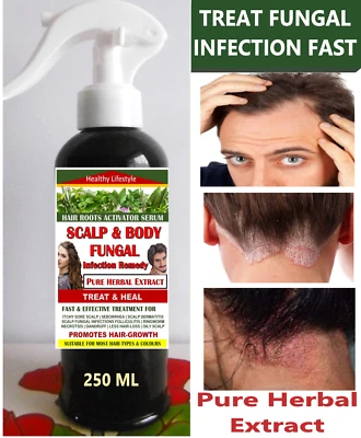 Potent Remedy Scalp | Body Fungal Infection Fast - PURE HERBAL EXTRACT 250 ML - Image 1 of 4
