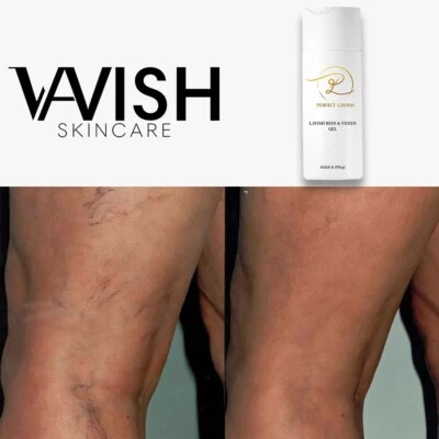 LAVISH Skincare, Sportgel kühlend | Bein & Venen Gel | Luxus Kosmetik  - Bild 1 von 4