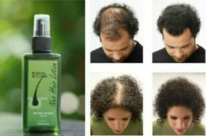 Neo Hair Lotion Natural Treatment For Hair Loss / Alopecia Men & Women 120ml