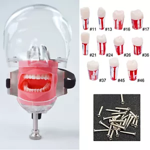10Pcs Dental Root Canal Teeth Study Model Endodontic Rotary Files Practice Block - Foto 1 di 63