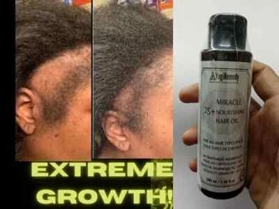 FAST HAIR GROWTH Organic Growth Oil Balding Thin Edges Miracle 100 ml To USA FS - Image 1 of 4