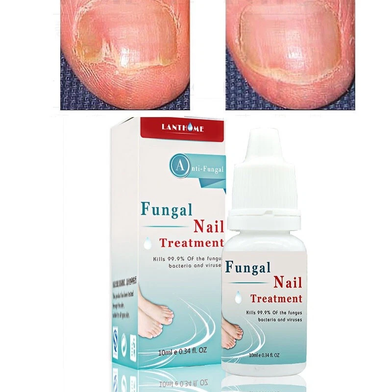 LANTHOME Fungal Liquid Nail Treatment Nail And Foot Whitening Toenail Fungu 10ml