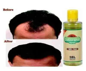 SBL Jaborandi Homeopathy Hair Oil Prevents Hair Fall & Hair Growing 100ml | F.S - Picture 1 of 2