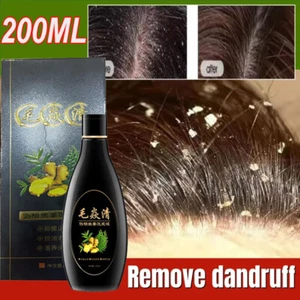 2025 Scalp Hair Follicle Shampoo Antibacterial Anti-Itching Mites Oil Control US - Picture 1 of 14