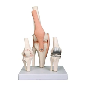 Premium Knee Joint Model Anatomy Set | Life Size Knee Joint + 2nd Stage Osteoart - Picture 1 of 11