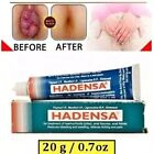 Hadensa Ointment used in the treatment of piles 20gm fissures, and anal fistula.