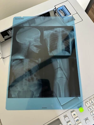 Nueva impresora a color DICOM integrada Printronix LP654C sistema de imágenes médicas A4 Foto 1 de 4