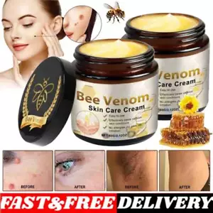 Bee Venom Treatment Cream - Professional Correcting Gel for All Skin Types 1~3x - Foto 1 di 14