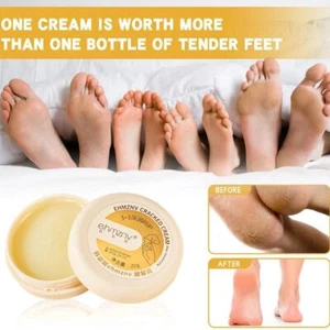 Anti-Cracking Heel Balm Repair Cream for Dry Cracked Feet/ - Picture 1 of 18
