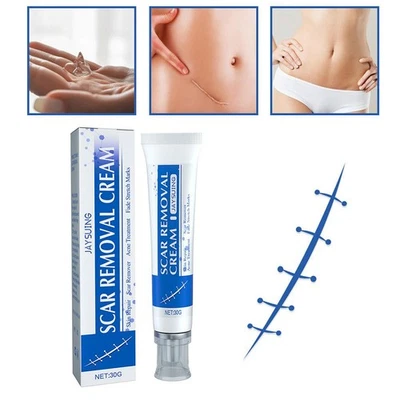 SCAR REMOVAL CREAM SkinRepair Scar Remover,Fade Mark Acne,Treatment ^uk| - Image 1 of 4