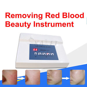 30MHz High Frequency Vascular Removal Face Body Spider Veins Removal Machine