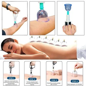 12PCS Cupping Vacuum Massage Cups Therapy Set Health Acupuncture Suction UK - Picture 1 of 11