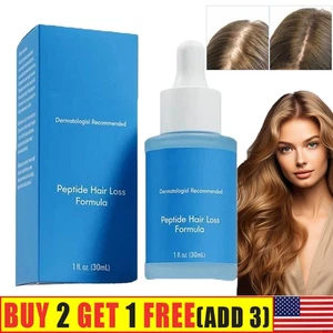 Peptonix Copper Peptide Hair Regrowth Serum 30 ml - Advanced Hair Growth Formula - Picture 1 of 9