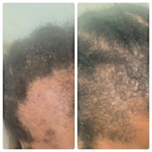 5g -1kg 100% ORIGINAL CHADIAN SAHEL CHEBE POWDER DIRECT FROM CHAD savannah