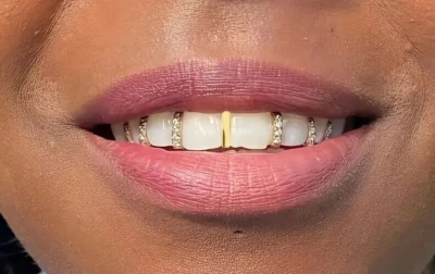 Custom Fit 14K Gold Plated Mouth Teeth Iced CZ Gap Grillz 7pc Set + Molds - Image 1 of 2
