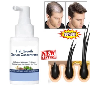 Siero concentrato per la crescita dei capelli 30 ml con cheratina vegetale e acqua di riso🥇DE - Foto 1 di 13
