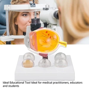 Enlarged Human Eye Anatomical Model Accurate Shows Medical Eyeball Model b4e3 - Picture 1 of 11