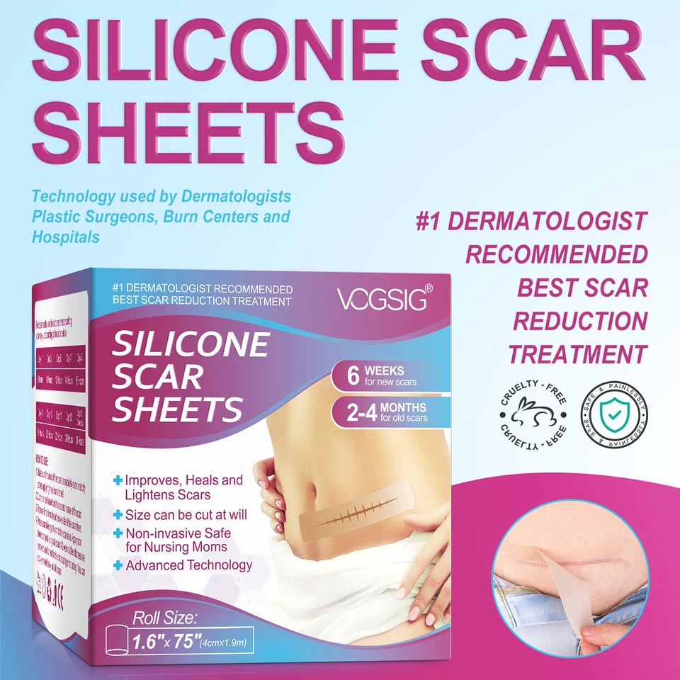 Cinta de silicona para eliminación de cicatrices para cicatrices hipertróficas y queloides, 1,6'' x 60''-150" Foto 1 de 4