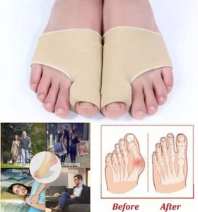 1 Pair Big Toe Bunion Corrector Splint Straightener Hallux Valgus Pain Relief US - Picture 1 of 13
