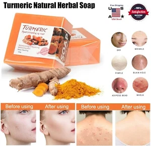 2× Turmeric Soap Natural Herbal Handmade Soap For Acne And Dark Spots Whitening - Picture 1 of 12
