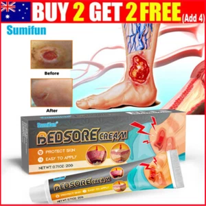 1PCS Bed Sore Cream Bedsore Ointment Bed Sores Treatment Fast Wound 20g AU - Picture 1 of 11