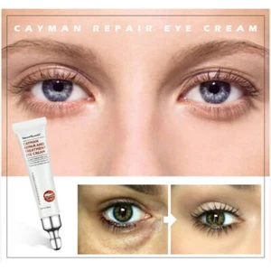 2Pcs Anti Puffiness Wrinkle Eye Cream Instant Eye Bags Dark Circles Removal - Picture 1 of 10