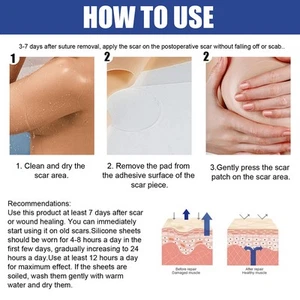 Silicone Scar Sheets for Breast Scar Removal Sheets Areola Strips Anchor Sheets - Picture 1 of 10