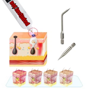 Laser Plasma Pen Needles For Eyelids Lifting Tattoo Mole Freckle Remover Tool - Picture 1 of 17