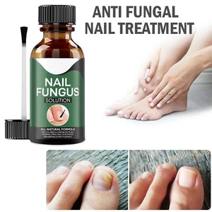 ANTI FUNGAL TREATMENT EXTRA STRENGTH TOENAIL FUNGUS ATHLETES FOOT FUNGI NAILS - Picture 1 of 18