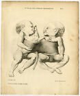 Antique Print-MISCARRIAGE-SIAMESE TWINS-HUMAN-SHEEP-Vrolik-Meijer-1840