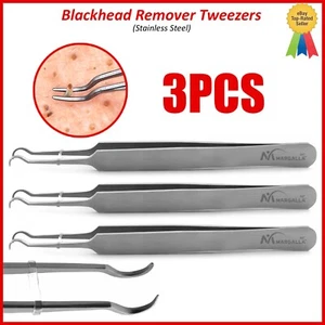 Juego de 3 Pinzas Curvas Removedor de Espinillas Extractor de Espinillas Herramienta para Manchas de Acné - Imagen 1 de 4