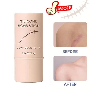 Silicone Scar Stick Scar Solutions 6.8g Scar Repair Cream - Picture 1 of 13