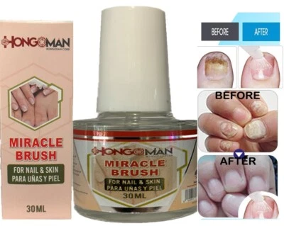 Nail Fungal support Hongosan Miracle Brush FREE SHIPPING Toe & Fingers Maximum