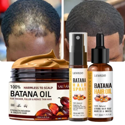 Batana Oil Serum Hair Growth Healthier Thicker Fuller Anti Hair Loss Conditioner - image 1 of 4