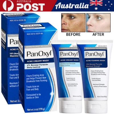 PanOxyl Benzoyl Peroxide 10% Foaming Acne Wash Skin Care 4% Daily Control Cream - image 1 of 4