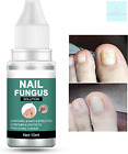 Fungal Nail Treatment for Toenail Extra Strong, Safety Effective Nail Fungus Toe