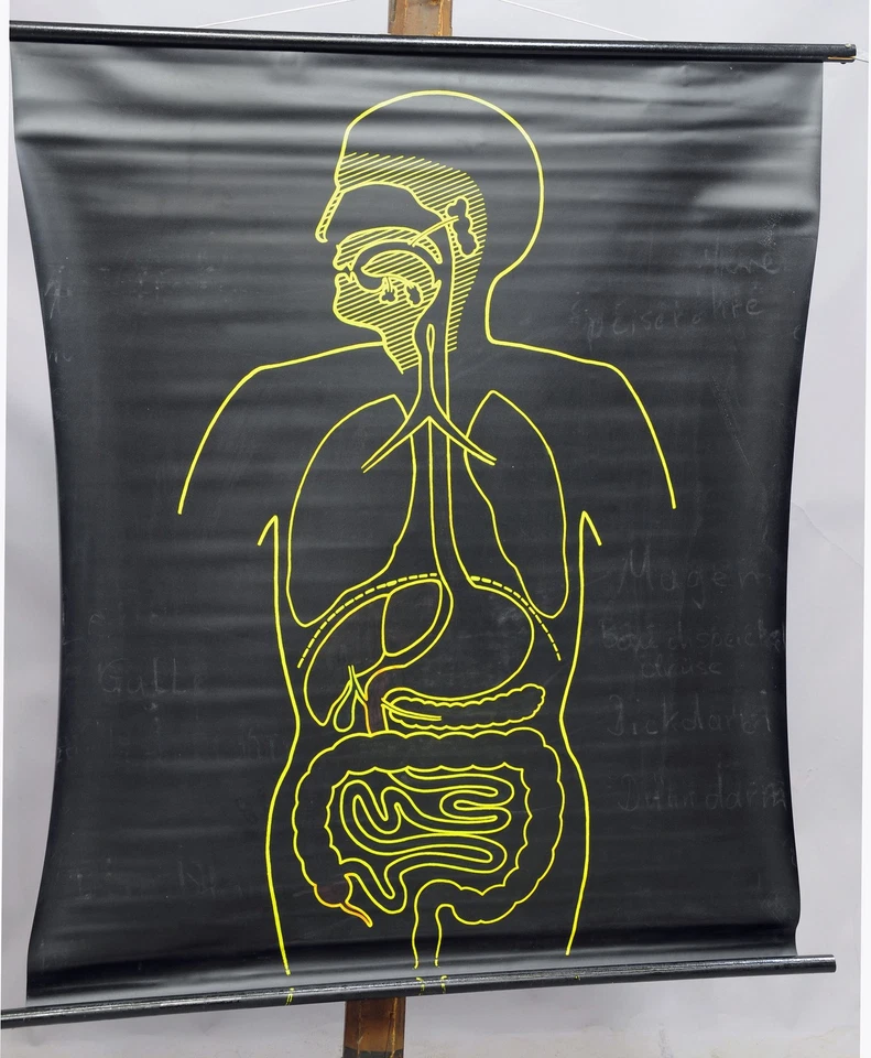 gráfico de pared extraíble negro amarillo órganos de anatomía humana Foto 1 de 1