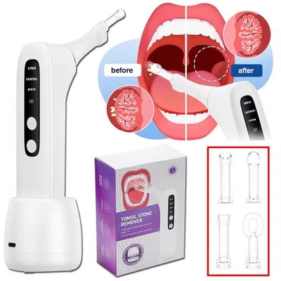 HAILICARE Electric Vacuum Tonsil Stone Remover Kit Tonsil Stone Cleaner 3 Suction Modes