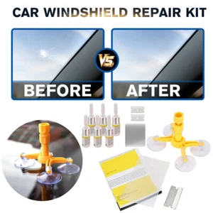 Windshield Repair Kit Quick Fix Car Wind Glass Bullseye Rock Chip Crack Star - Picture 1 of 12
