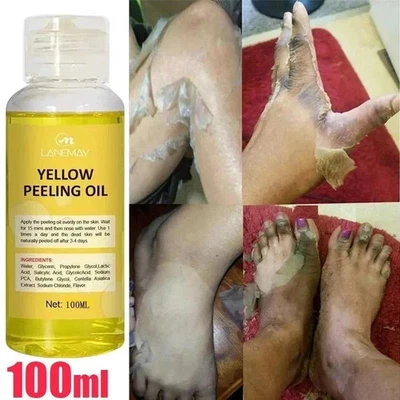 Body Care Exfoliating Yellow Peeling Oil 100% Organic Bleaching Dark Skin Serum - Image 1 of 4
